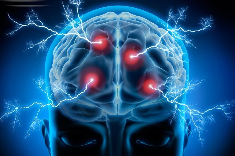 Multiple Sclerosis